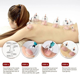 BỘ GIÁC HƠI 32 CỐC - Bộ Giác Hơi Không Dùng Lửa Cao Cấp