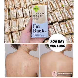 XÀ PHÒNG MỤN LƯNG FOR BACK