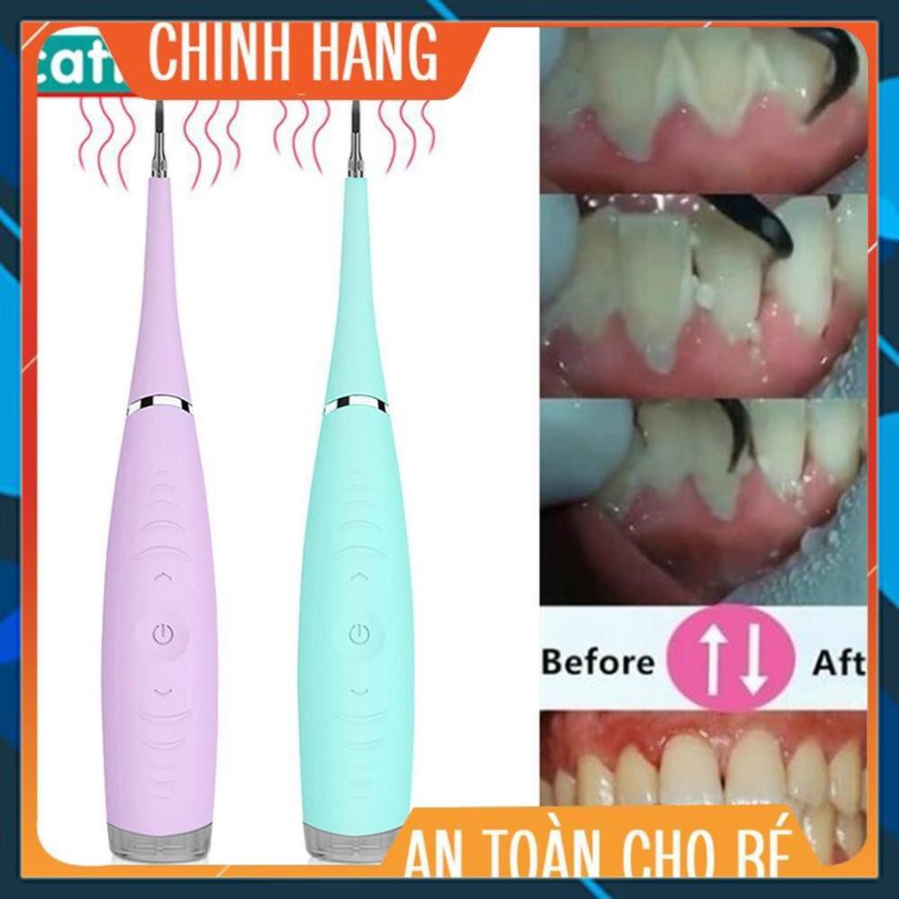 [LN123] Giảm giá dùng thử    Dụng cụ lấy cao răng tại nhà sonic pic 3000 (giao siêu nhanh)