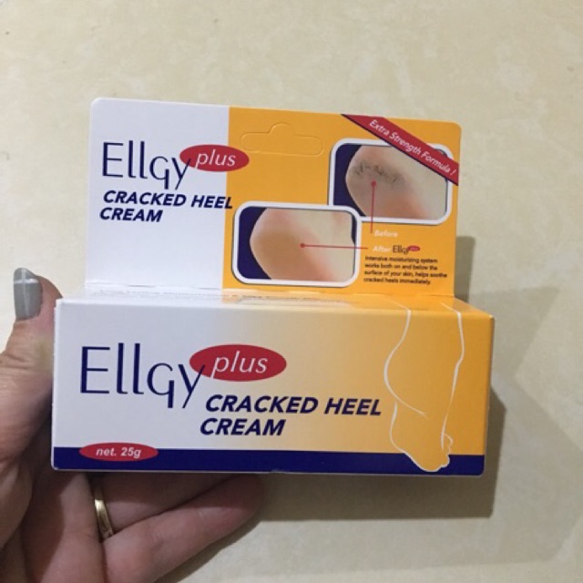 Kem trị nứt gót chân ellgy plus