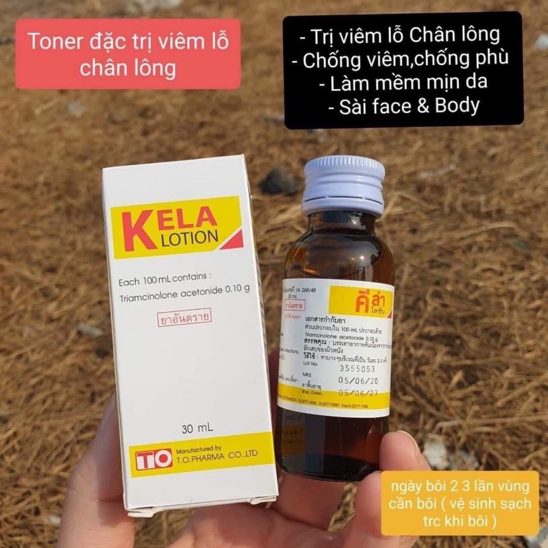 KELA LOTION Dành cho da Viêm Lỗ Chân Lông. | BigBuy360 - bigbuy360.vn