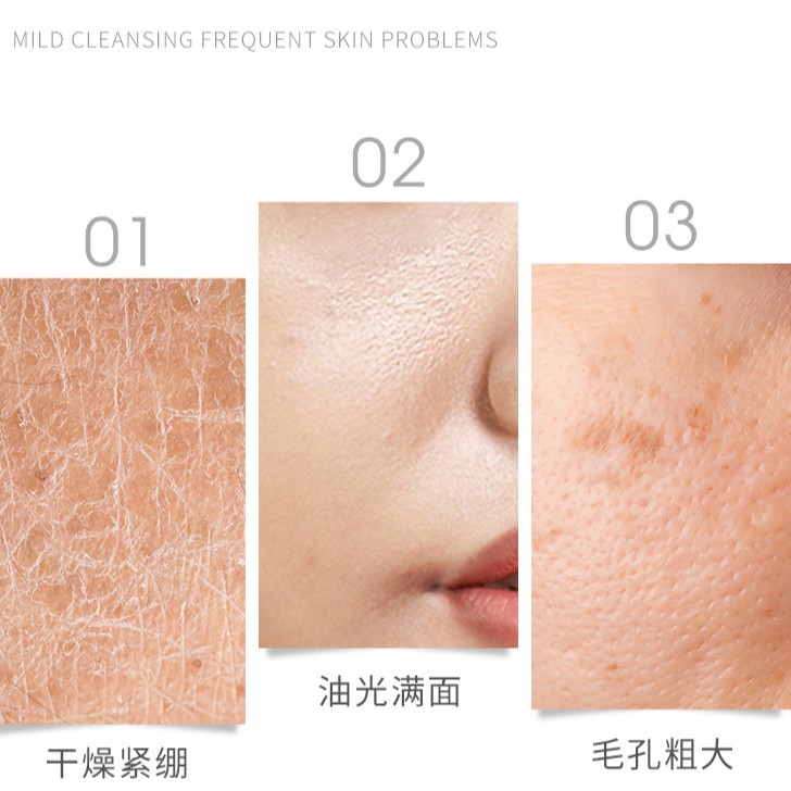 Sữa Rửa Mặt Dạng Gel YZKMSKIN Kind To Skin Refreshing Facial Wash 60g