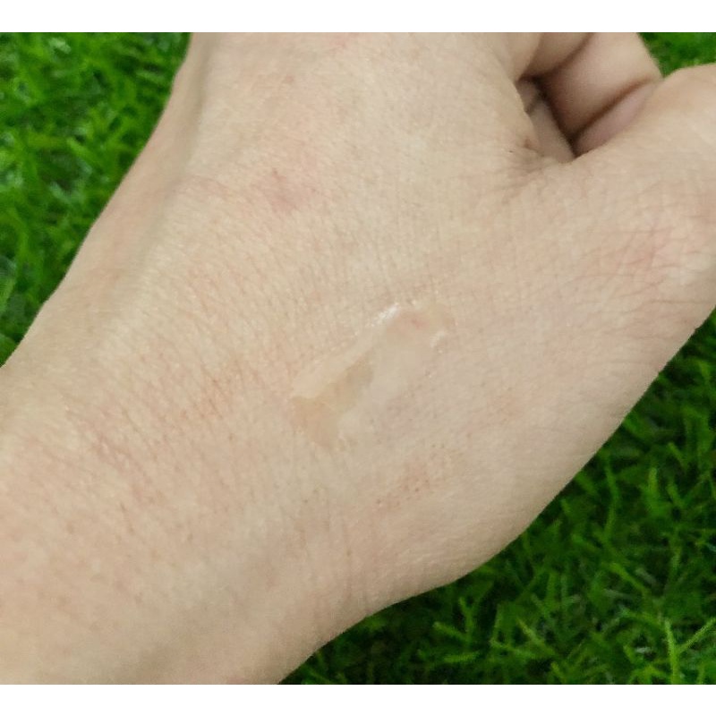 Gel vá da che mụn Real Skin Patch | BigBuy360 - bigbuy360.vn