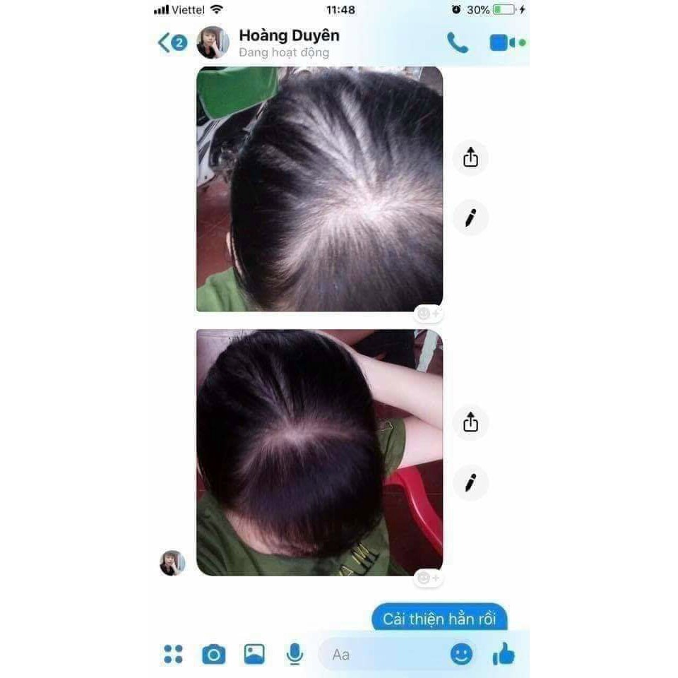 [CHÍNH HÃNG] DẦU GỘI THẢO DƯỢC DÂN GIAN THANH MỘC HƯƠNG SẠCH GÀU, MƯỢT TÓC, NHANH MỌC TÓC | BigBuy360 - bigbuy360.vn