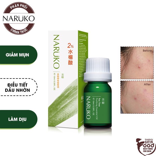 Tinh Dầu Tràm Trà Hỗ Trợ Giảm Mụn Naruko Tea Tree Purifying Essential Oil