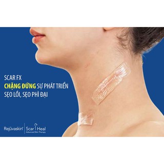 Miếng dán xoá mờ sẹo lồi/ phì đại Scar FX
