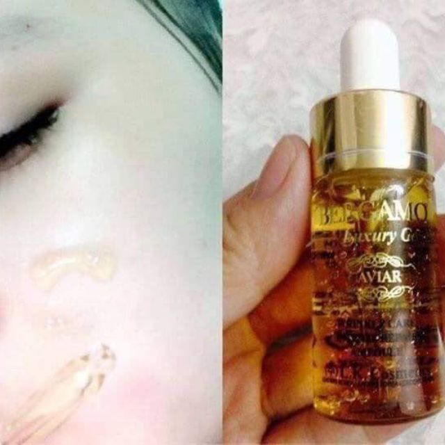 Serum Bergamo Hàn chính hãng