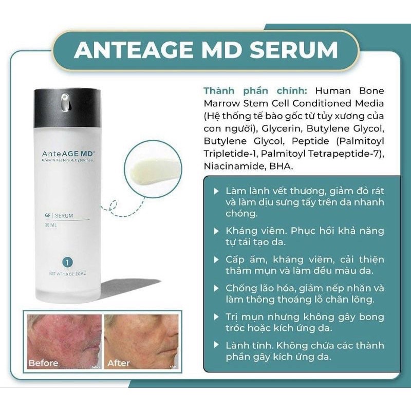 Combo AnteAGE MD Serum Và Accelerator Dưỡng Ẩm, Bảo Vệ, Tái Tạo Và Trẻ Hoá Làn Da 30ml
