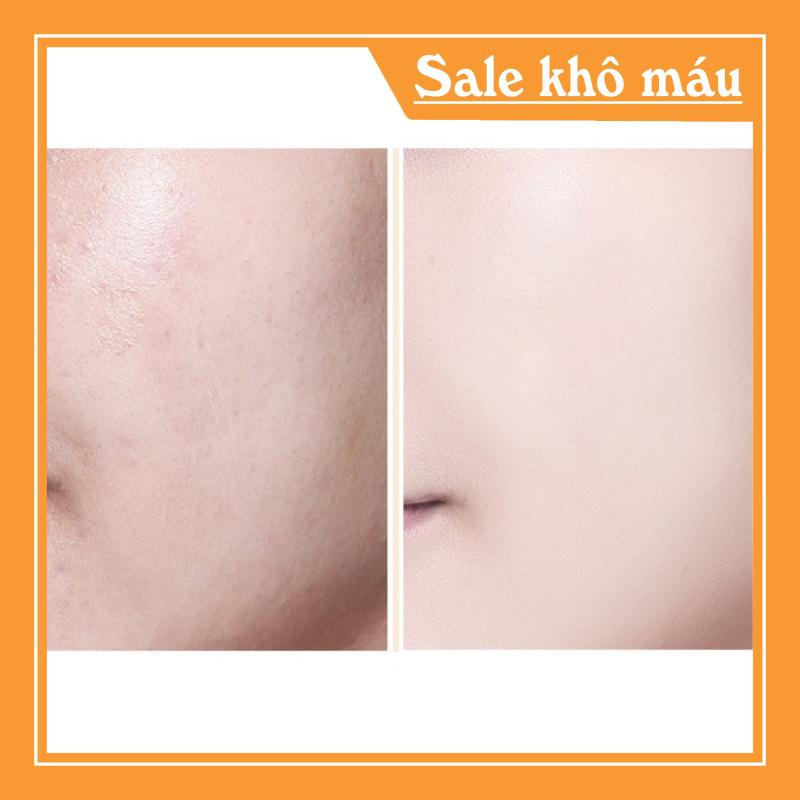 Kem Nền BB Cream Lameila PERFECT REPAIR Cream 30g Auth Nội Địa sỉ tốt - PIG PIG (hàng sẵn) | BigBuy360 - bigbuy360.vn