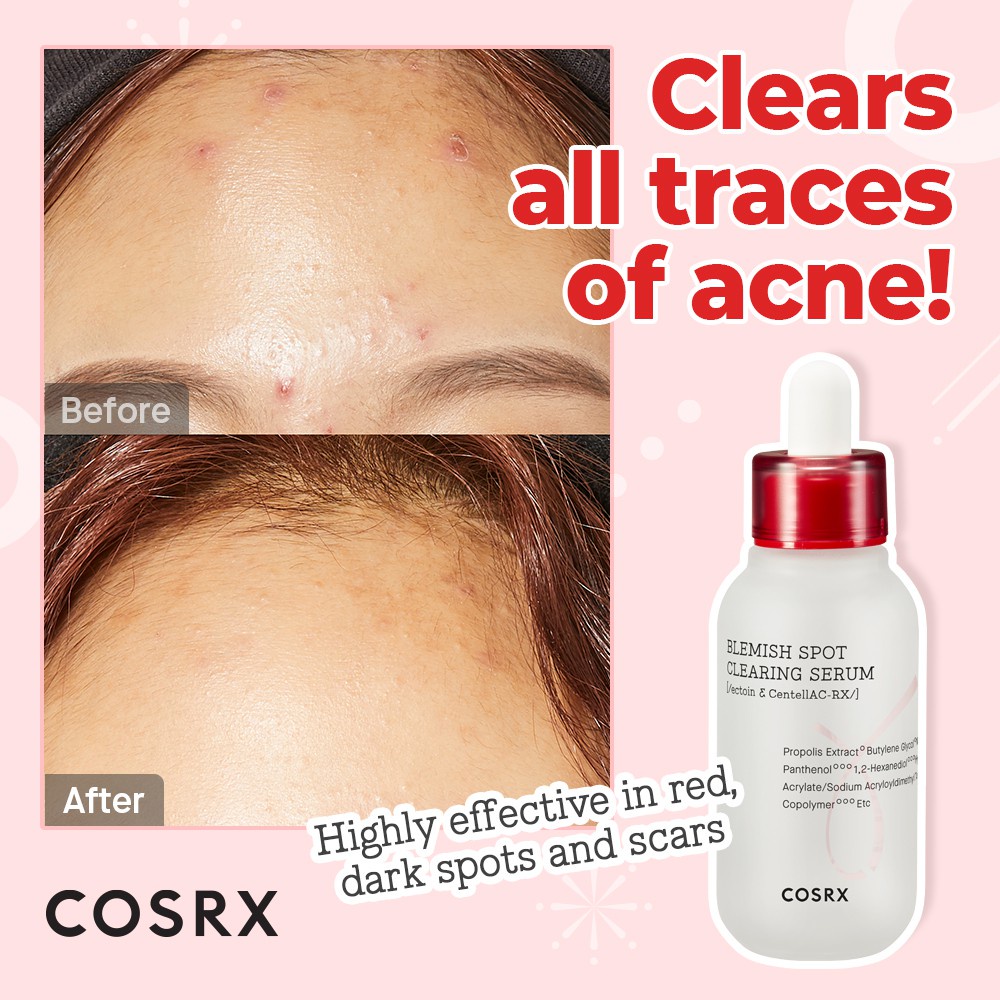 Line dưỡng chăm sóc da mụn COSRX AC COLLECTION