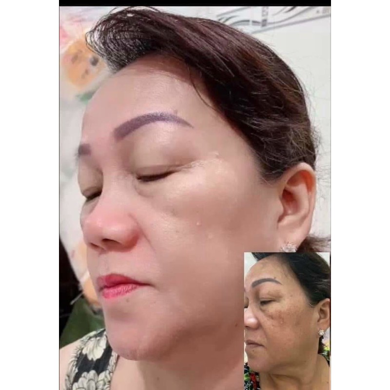 Kem tái tạo chamomile