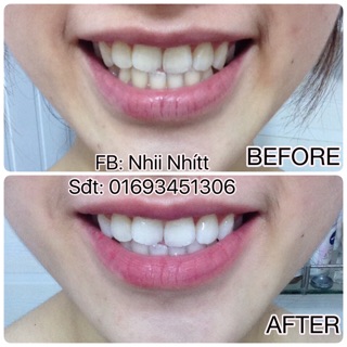 Miếng dán trắng răng Crest Supreme Professional Whitening Strips 7days