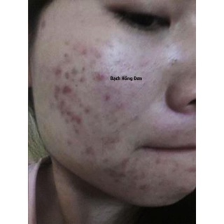 Kem dưỡng Bạch hồng đơn