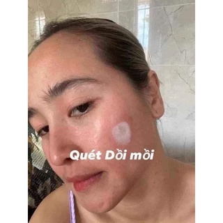 SÉT LẺ TCA CHẤM TÀN NHANG NÁM 35%