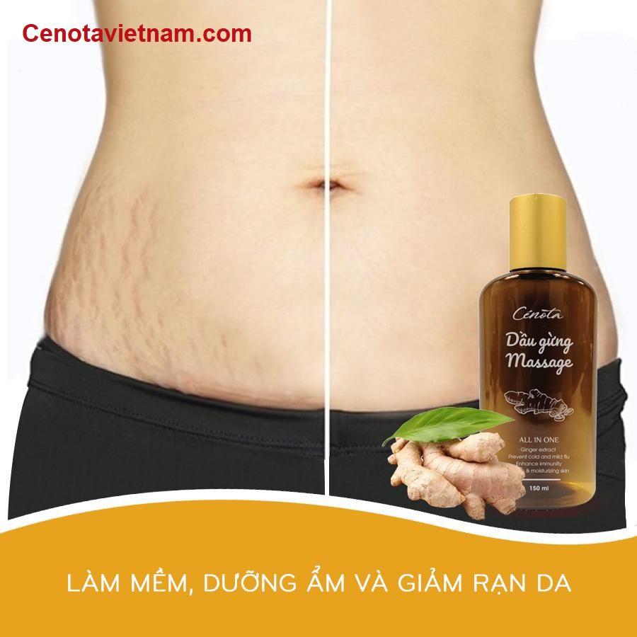 Dầu Gừng Massage Cenota Massage Thư Giãn, Giảm Đau Đầu, Đau Khớp 150ml