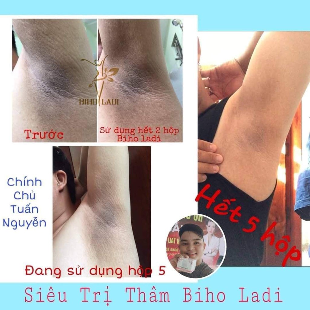 [chinh hãng] siêu dưỡng thâm 5s biholadi giúp xóa thâm vùng : nách , bụng , bẹn , mông , ti , khuỷu tay , đầu gối... | BigBuy360 - bigbuy360.vn