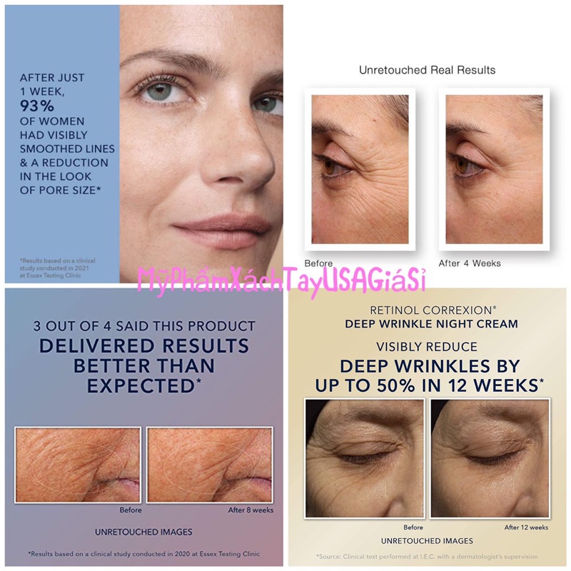 [USA]Tinh chất chống lão hóa làm mềm mại nếp nhăn RoC Retinol Correxion Line Smoothing Daily Serum 30ml