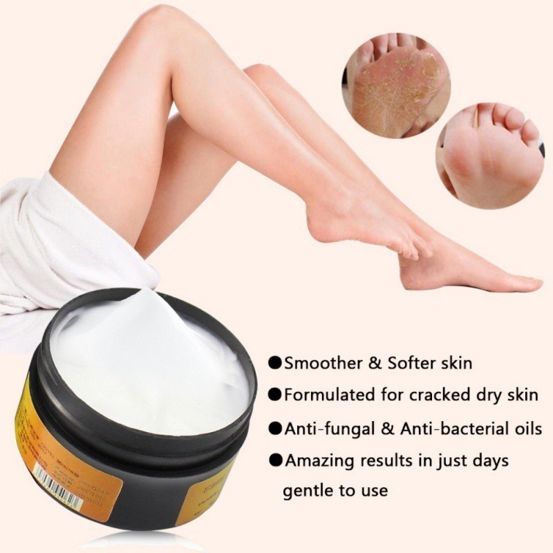 Kem hỗ trợ giảm nứt nẻ gót chân từ mỡ ngựa giữ ẩm và cải thiện da