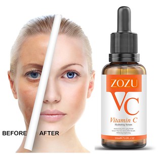 SERUM VITAMIN C ZOZU TÁI TẠO LÀN DA SIÊU HOT