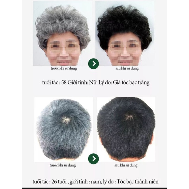 CỰC CHẤT VỚI CHAI TINH DẦU XỊT ĐEN TÓC DƯỠNG TÓC CHĂM SÓC TÓC CHO NAM VÀ NỮ HÀNG CHUẨN