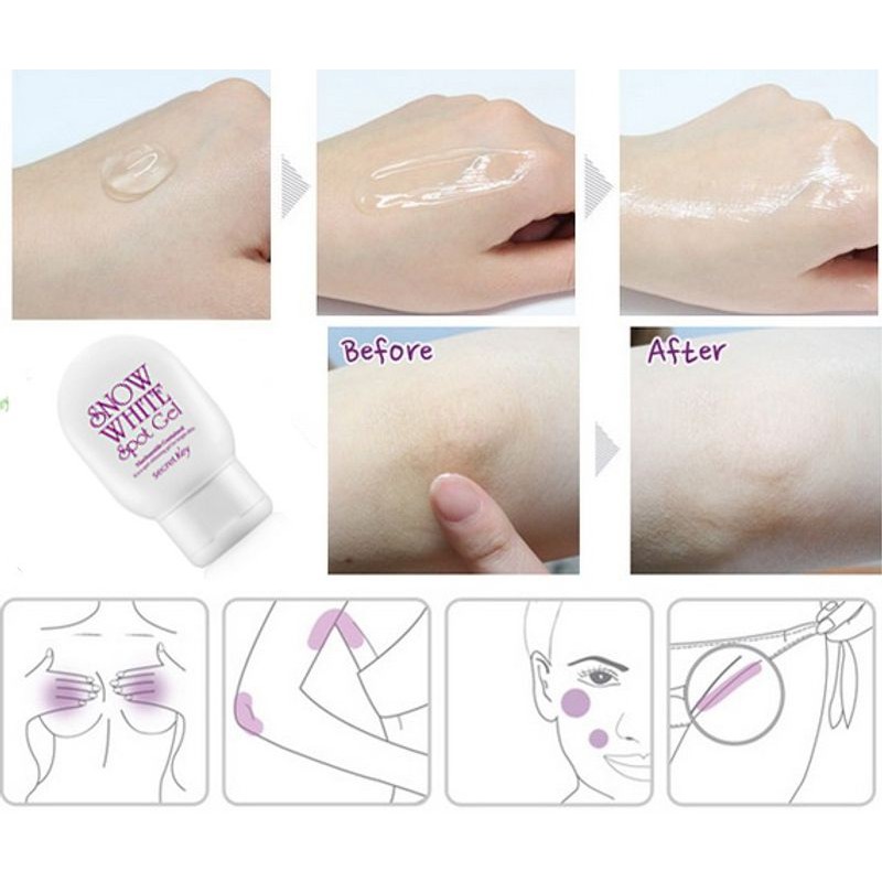 (chính hãng, nhãn phụ tiếng việt) Gel giảm thâm #𝐒𝐞𝐜𝐫𝐞𝐭_𝐊𝐞𝐲 #𝐒𝐧𝐨𝐰_𝐖𝐡𝐢𝐭𝐞 #𝐒𝐩𝐨𝐭_𝐆𝐞𝐥