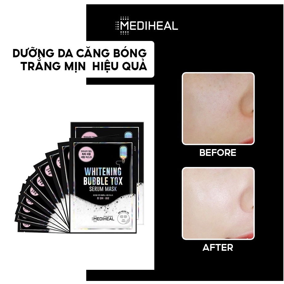 Mặt Nạ Sủi Bọt Thải Độc, Dưỡng Trắng Da Mediheal Whitening Bubble Tox Serum Mask 25ml