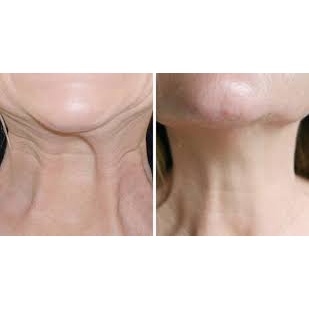 Kem Nâng Cằm Cổ Ngực Novosvit 50ml Nga. | BigBuy360 - bigbuy360.vn