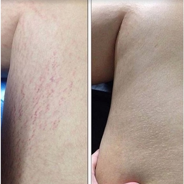 Tẩy da chết Frank Body coffee scrub fullsize 200g (mùi cinnabuns, a-beauty, rose gold shimmer) | BigBuy360 - bigbuy360.vn