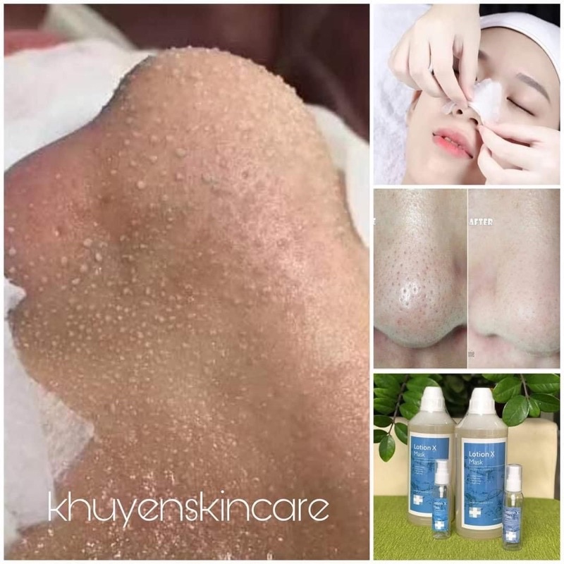 [Chính hãng] Ủ mụn đầu đen mụn cám Lotion X mask