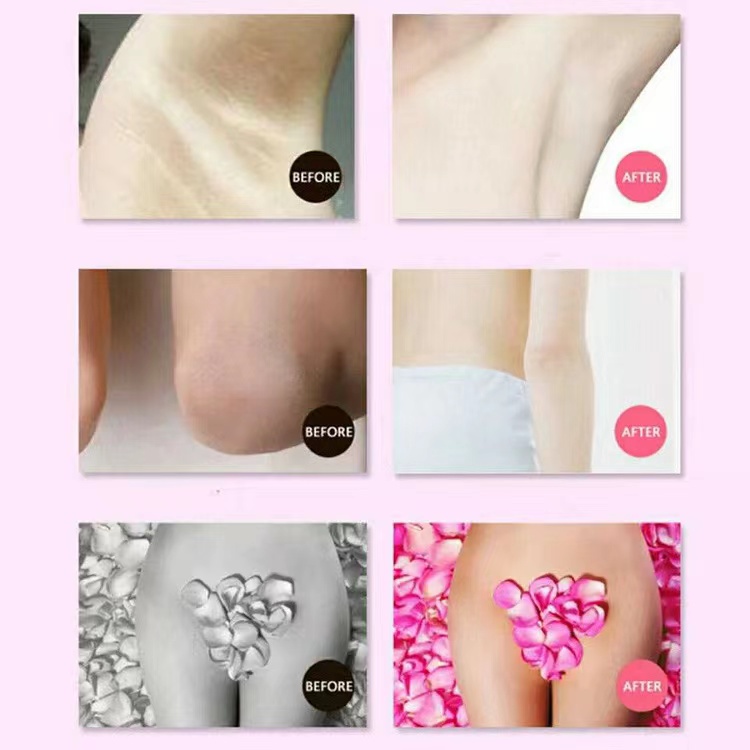 QIANSOTO Kem Làm Trắng Da Nách Giảm Thâm Đầu Gối Mông Bikini Khử Mùi Hôi Dưỡng Trắng Da 60g