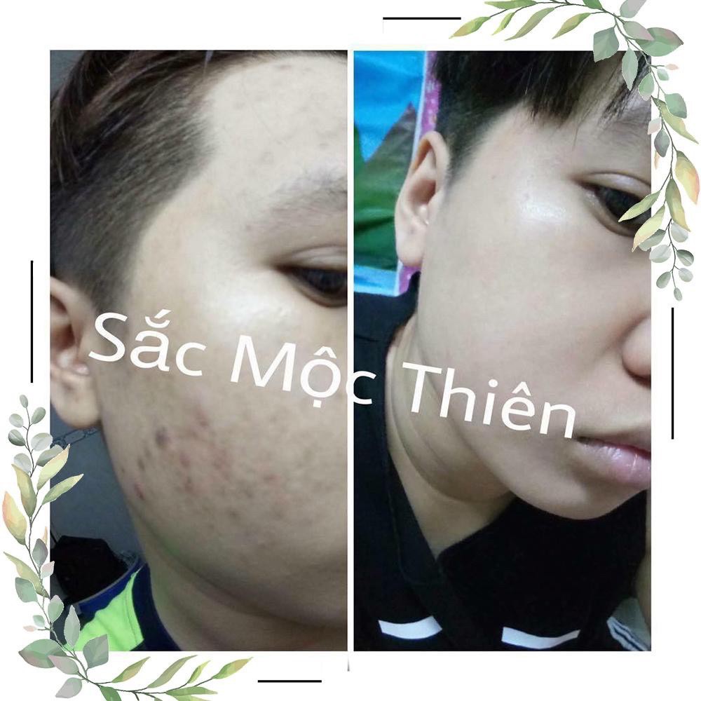 Serum Tinh Chất Giúp Tái Tạo Da Mua Kèm Hộp Quà May Mắn Sắc Mộc Thiên 30ml