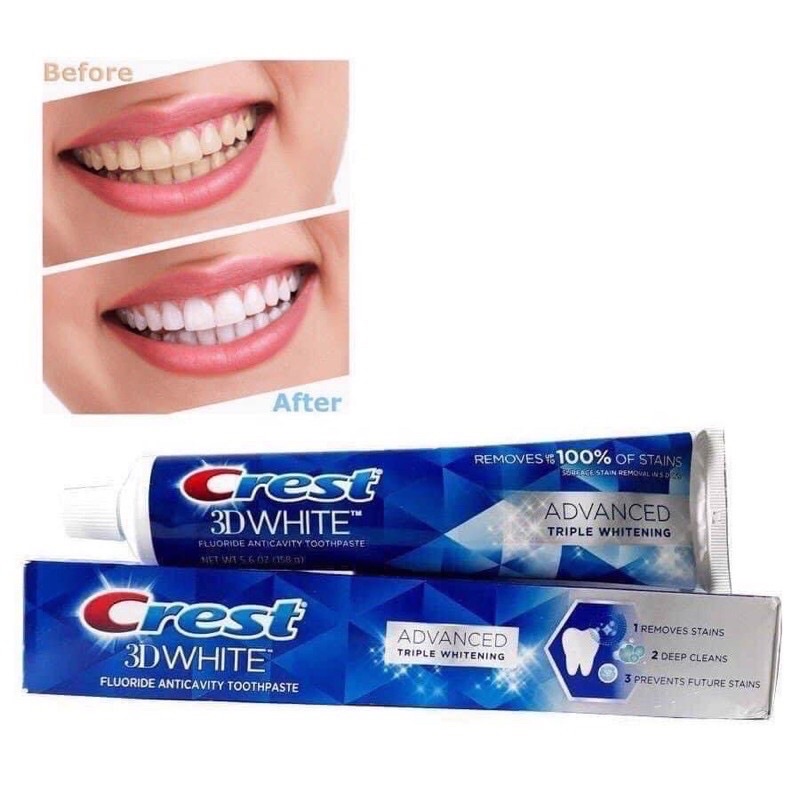 Kem đánh răng siêu trắng sạch mảng ố Crest 3D White Advanced Triple Whitening 158g Mỹ