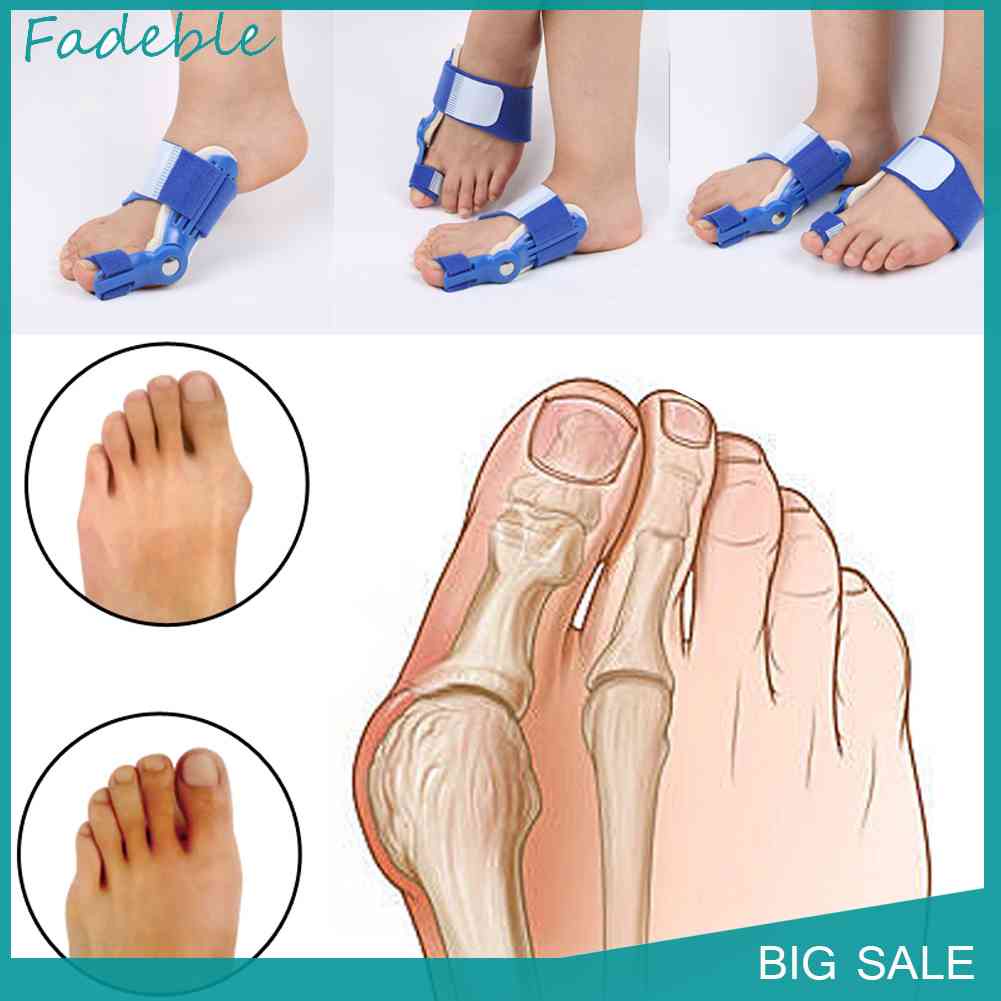 Dụng Cụ Nẹp Chỉnh Hình Ngón Chân Cái Vào Ngày Và Đêm