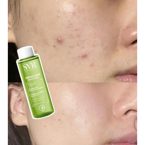Toner SVR Sebiaclear Micropeel 150ml