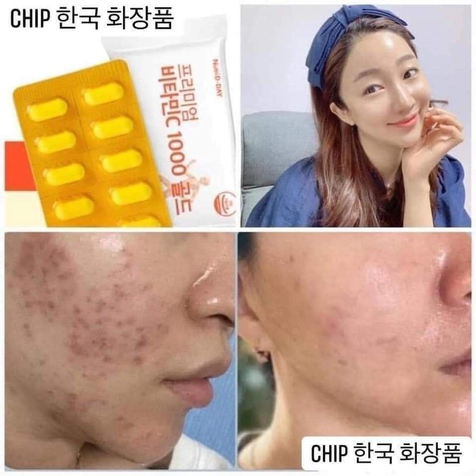 Viên Uống Vitamin C 1000mg Nutriday Chống nắng Trắng Da Hàn Quốc