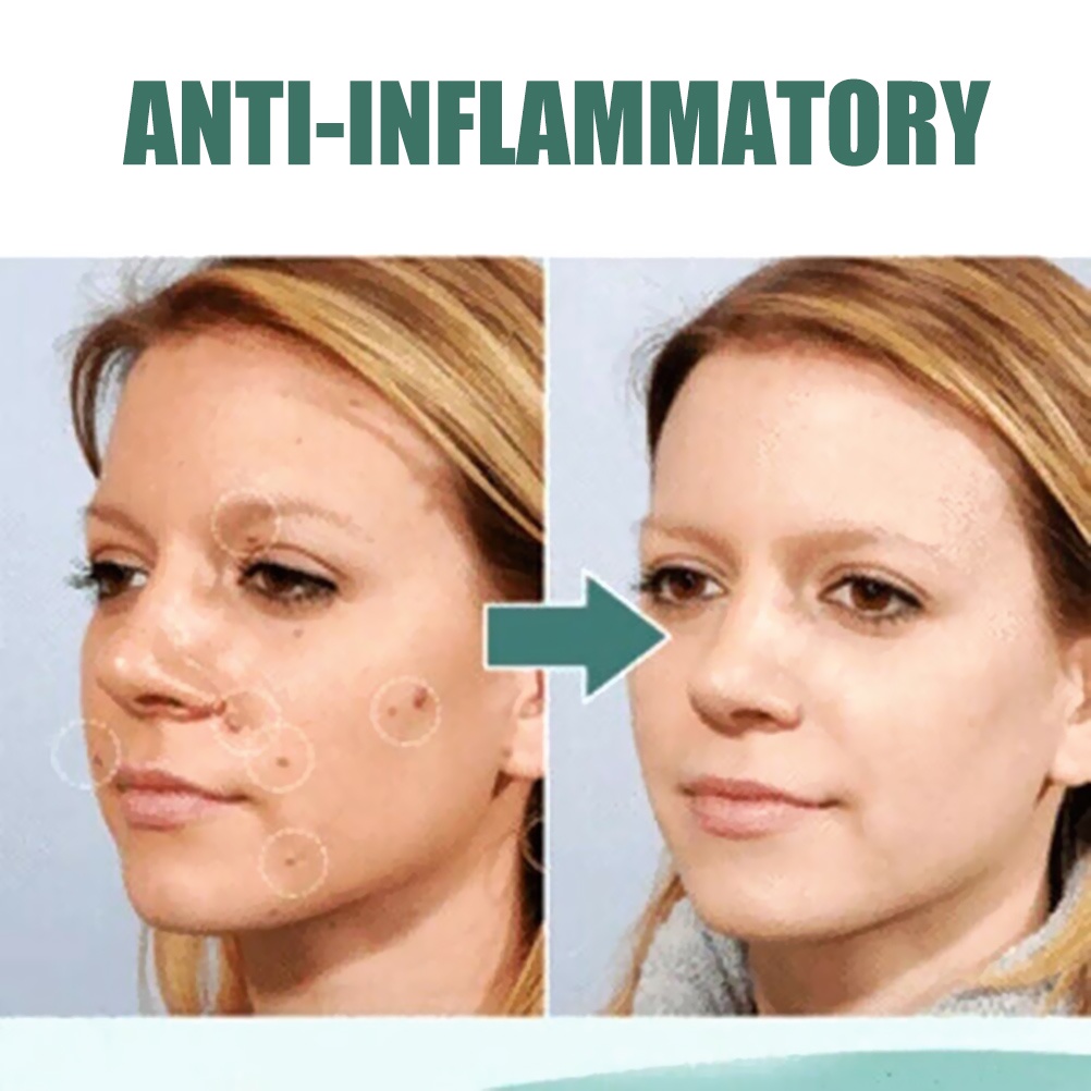 Dung dịch loại bỏ Mole hiệu quả cho da mặt 20ml | BigBuy360 - bigbuy360.vn