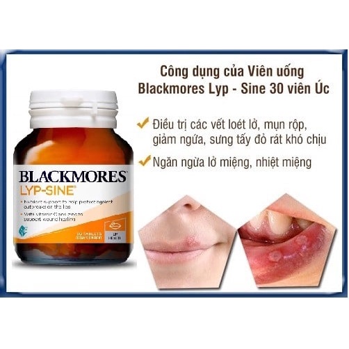 Viên Uống Blackmores Lyp - Sine 30 viên Nhiệt miệng