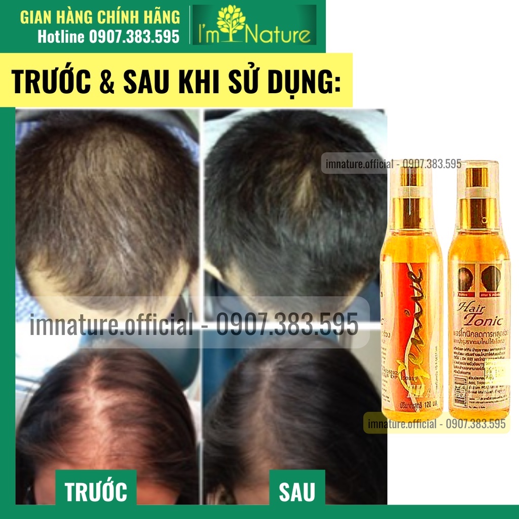 Chai Xịt Mọc Tóc GENIVE Thái Lan 120ml Tonic Hair