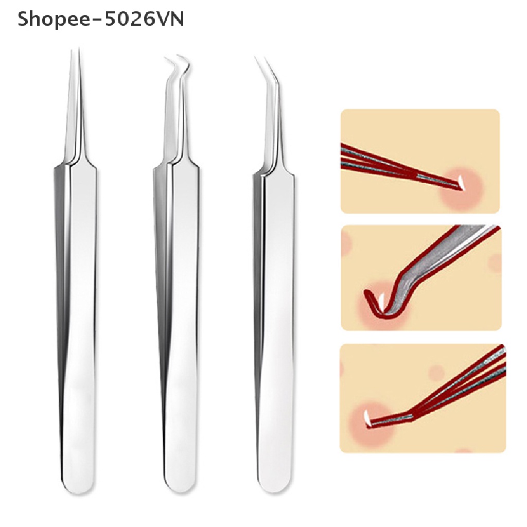 [Hàng mới về] Nhíp đầu thẳng/ xiên/ móc cong loại bỏ mụn đầu đen dụng cụ chăm sóc da mặt