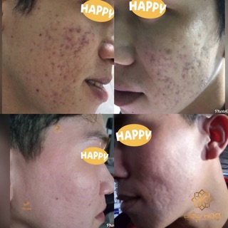 Serum Thảo Mộc OGANA