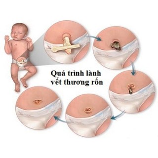 3 Hộp Băng Rốn Đông Fa Đã Tiệt Trùng Cho Bé (9 Chiếc)