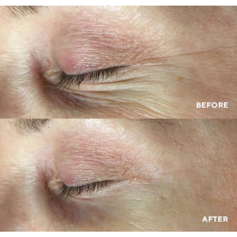 Tinh chất Copper Peptide  ✅ freeship ✅ giúp trẻ hoá da, phụ.c hồ.i da sau lăn kim