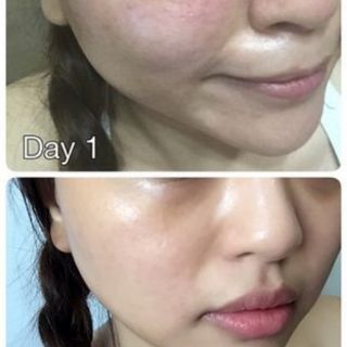 (SẴN)Viên cấp nước Innerb Aqua Rich