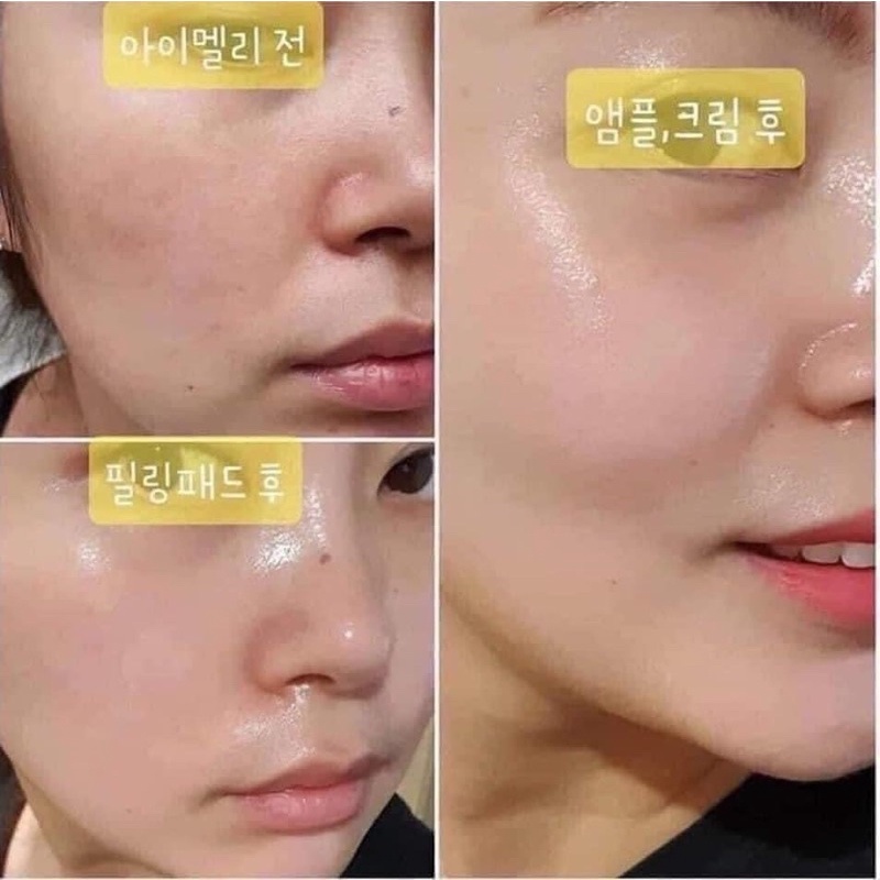 TINH CHẤT DƯỠNG  HYALURON COMPLEX AMPOULE 62% TRẮNG DA - VITA C COMPLEX AMPOULE 47%