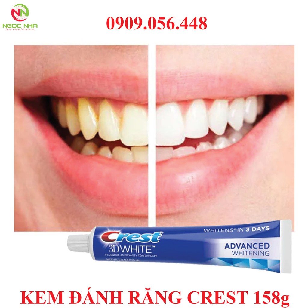 Kem đánh răng Crest 3D WHITE ADVANCED TRIPLE WHITENING 158G- Trắng răng gấp 3 lần, có flour ngăn ngừa sâu răng