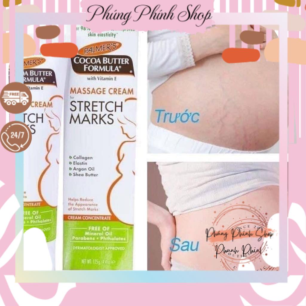 LOTION TRỊ RẠN DA PALMER'S