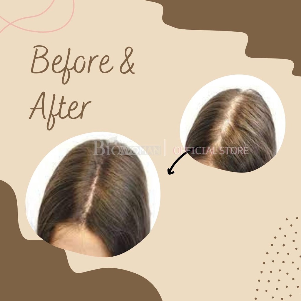 Dầu gội đầu thảo dược Biowoman Shampoo Extra kích thích mọc tóc ngăn ngừa rụng tóc 300ml chính hãng thái lan