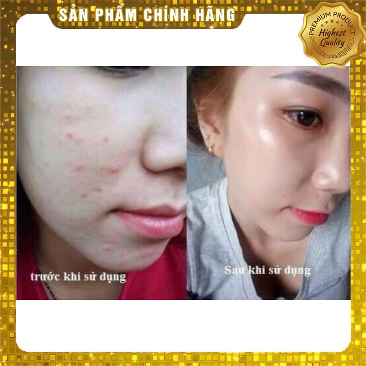 Serum trắng da 🍀 CHÍNH HÃNG 🍀Serum Bergamo giúp mờ tàn nhang, vết đốm, thâm mụn đem lại làn da tươi trẻ trắng sáng