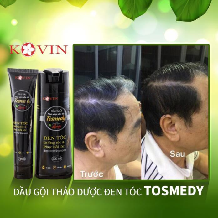 Dầu gội thảo dược đen tóc TOSMEDY của Công ty Cổ phần Dược TW Mediplantex Đen tóc chỉ sau 01 lần gội