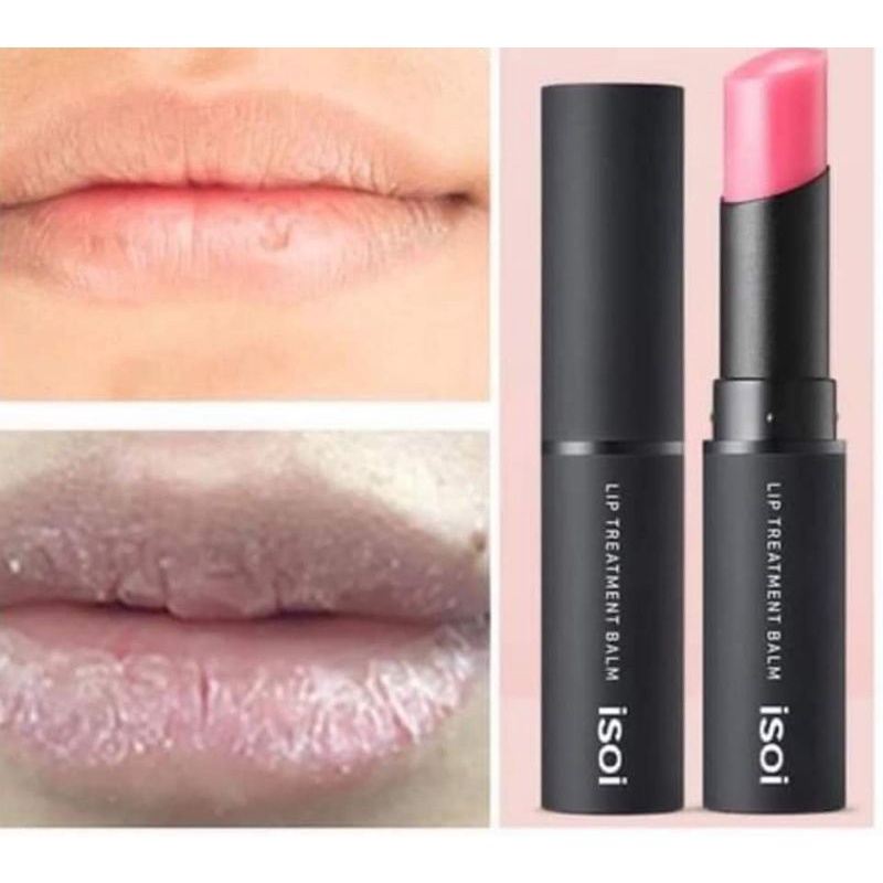 Son Khử Thâm Môi Isoi Bulgarian Rose Lip